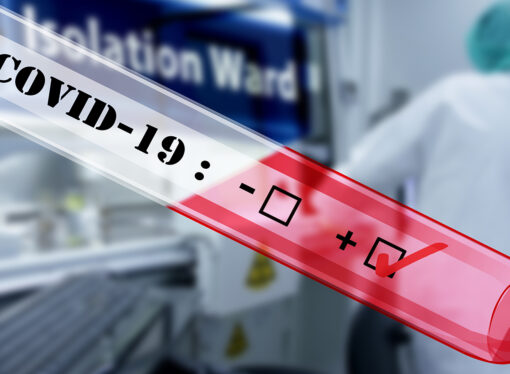 Government COVID-19 Tests Were Awful, Now Private Labs Are Saving the Day