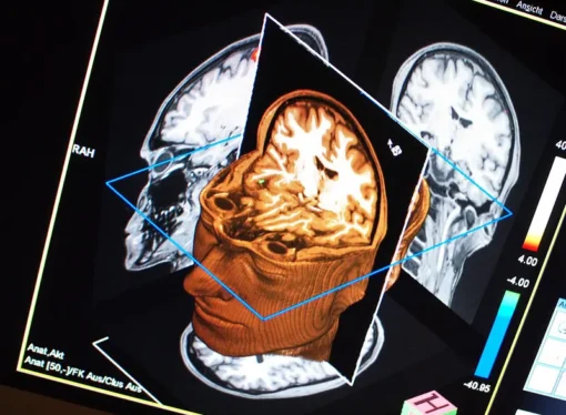Neurotheology, a Bridge Between Religion and Science